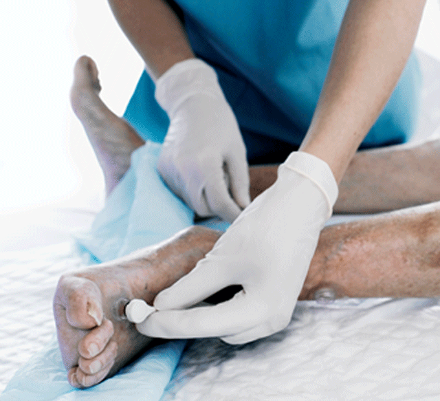 Wound care