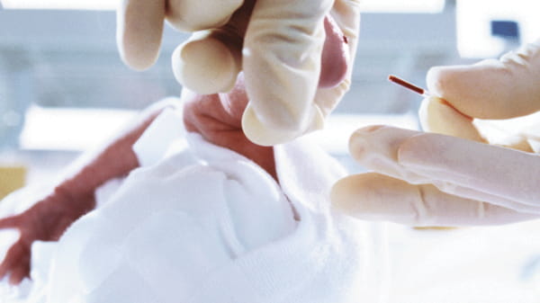 Egy használatban lévő Clinitube kapilláris vérvételi cső képe